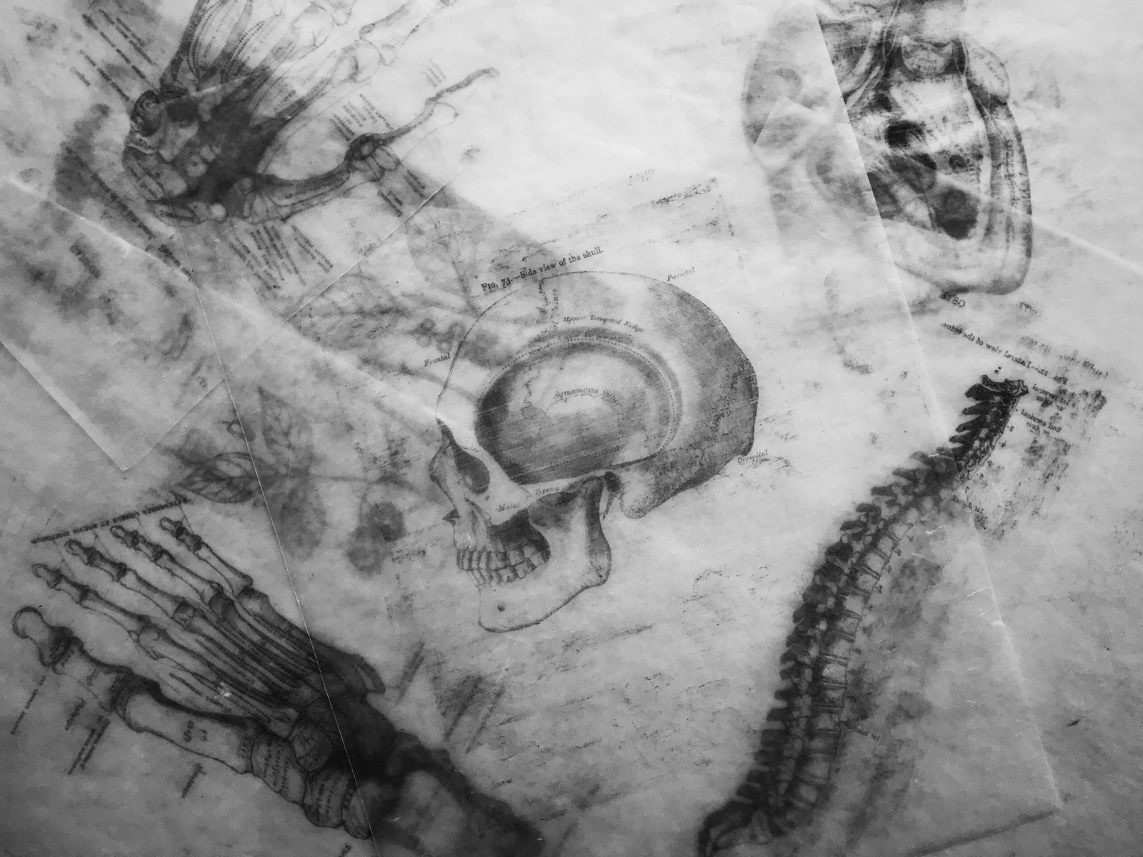 Illustration of skeleton images